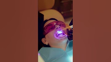 Composite Bonding Transformation | In 2 Hours