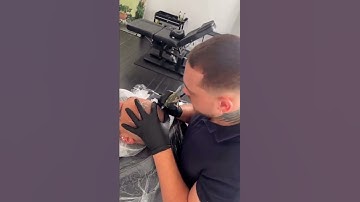 Scalp Micropigmentation. Not just restoring your hairline, you