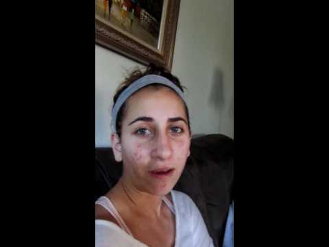 Video thumbnail: VLog of my Rhinoplasty Surgery, Recovery, #14 · NassifMD®