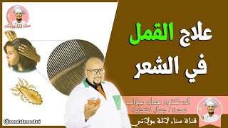 علاج القمل في الشعر / الدكتور عماد ميزاب
