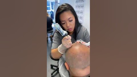 SMP- Scalp Micropigmentation Training and Treatment