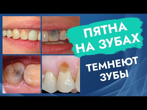 Видео: Как почернить зубы (Охагуро): 5 шагов (с иллюстрациями)