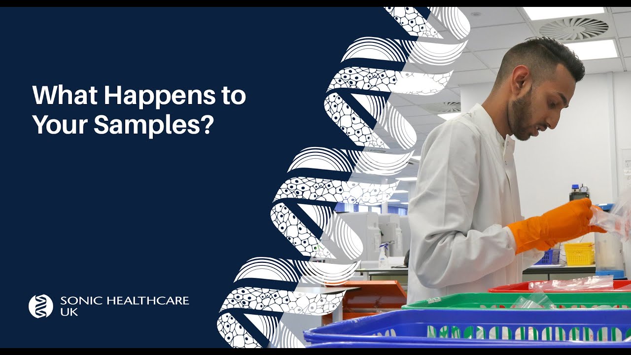 What Happens To Your Samples?