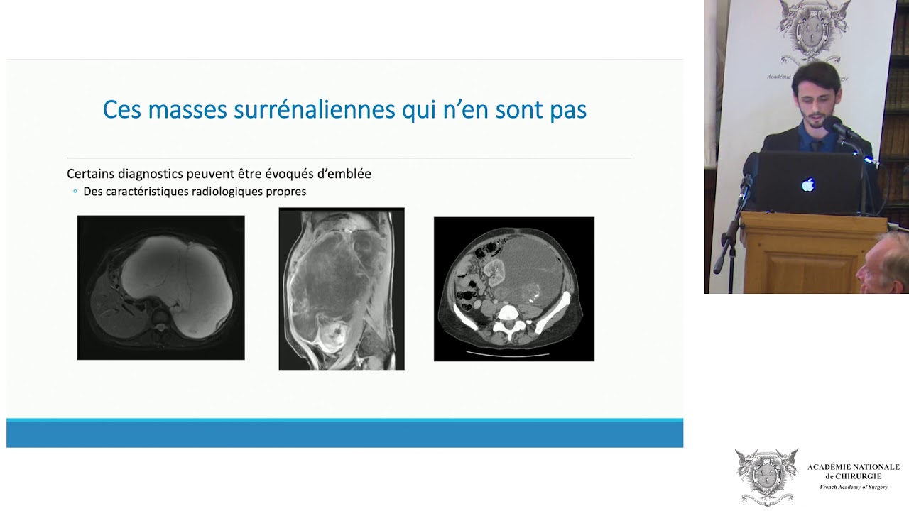 scanner-surr-nalien-protocole-hypertrophie-surr-nalienne-gauche