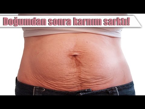 Video: Doğumdan Sonra Karnınızı Nasıl Düzleştirirsiniz?