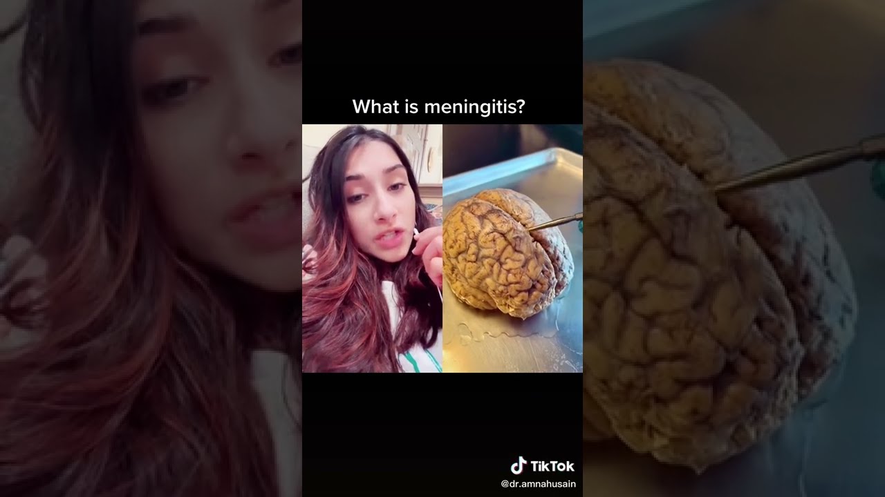 What Is Meningitis Pediatrician Explains Dr Amna Husain Shorts