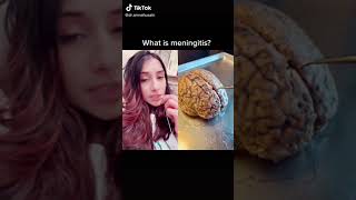 What is Meningitis? Pediatrician Explains! | Dr. Amna Husain #shorts #meningitis