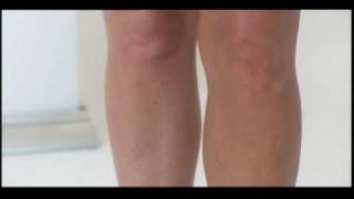 Xen-Tan Before and After Sunless Tanning Model