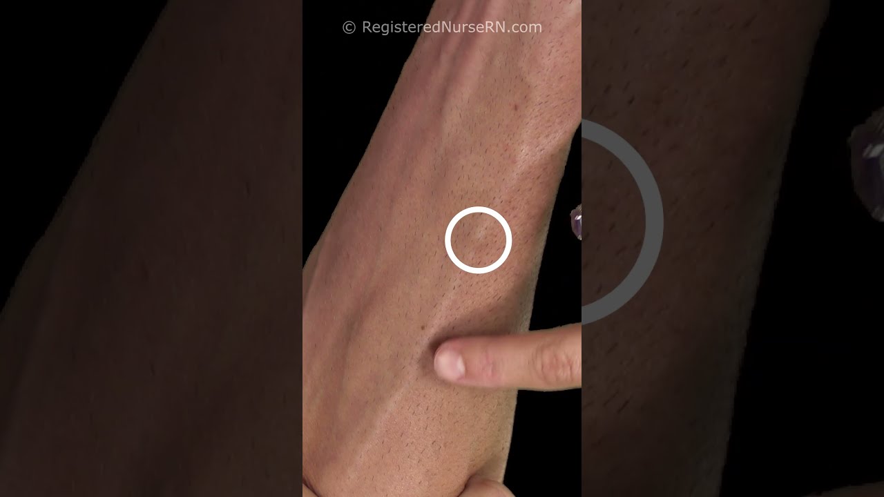 IV Insertion Nursing Tip Avoid Visible Vein Valves During Cannulation Iv Ivtherapy Nurse