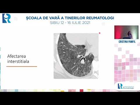 Afectarea pulmonara in vasculitele sistemice - Cristina Pamfil