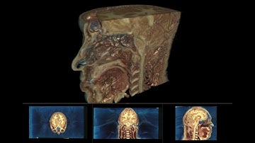 Color (RGB) volume rendering