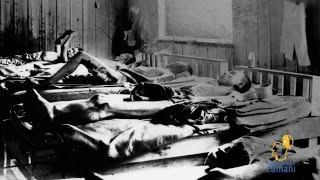 Hi̇roşi̇manın Dramı Sizi Çok Etkileyecek Kız Çocuğu