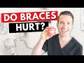 Why Do Braces Hurt When You First Get Them? | Braces Pain | Dr. Nate