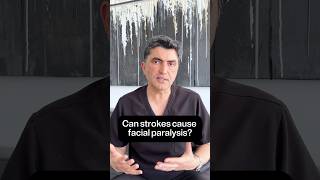 Can strokes cause facial paralysis? #facialparalysis #stroke