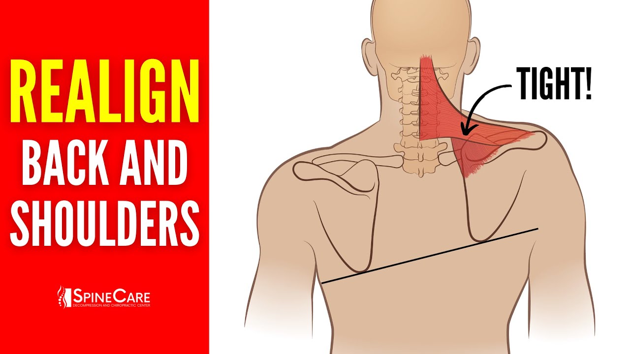 Best Exercises to Realign Your Back and Shoulders - YouTube