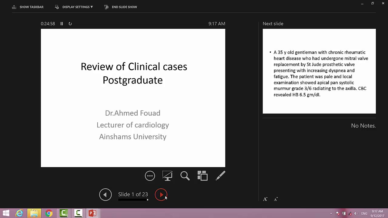 Clinical cases valvular heart disease 3 - YouTube