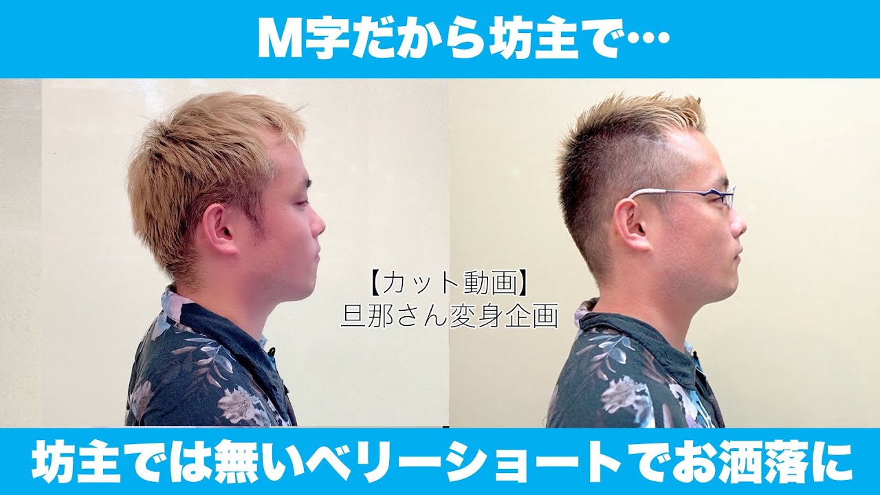 m 字 はげ 坊主