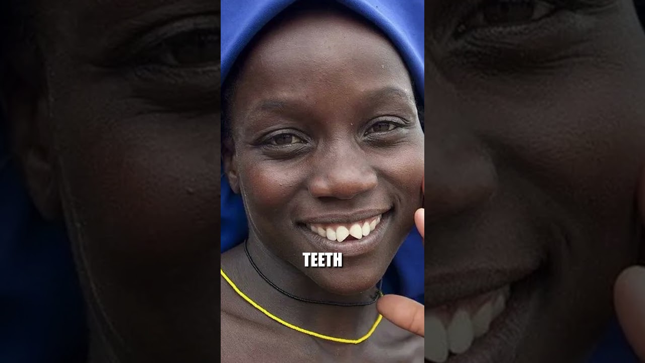 Why Tribes have Straight White Teeth pt. 2 🦷 #tribe #travel #dentistry