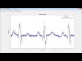 Signal Processing with MATLAB