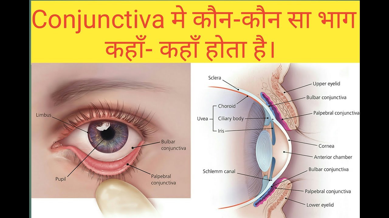 Palpebral , Bulber & Fornix conjunctiva कहाँ कहाँ होते हैं। - YouTube