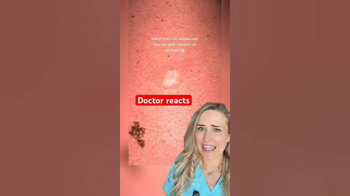 The internet found her CANCER from this video