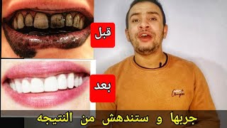 ارخص و اسرع و افضل طريقه لتبييض الاسنان في المنزل