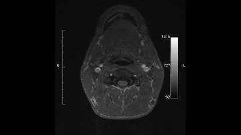 MRI brain scan: horizontal slice