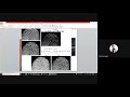 Digital Image Processing Lecture 2