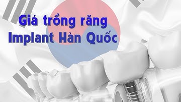 Giá trồng răng implant Hàn Quốc - Giá cấy ghép implant Hàn Quốc