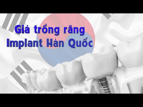 Video Giá trồng răng implant Hàn Quốc - Giá cấy ghép implant... - YouTube