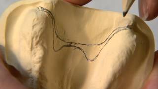 KF CDP Module 8: Posterior palatal seal master cast modification. screenshot 3