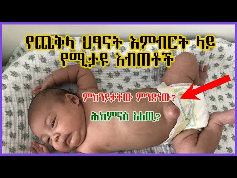 ቪዲዮ: አዲስ እምብርት መበሳትን እንዴት እንደሚንከባከቡ (ከስዕሎች ጋር)