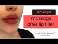 Lip Filler Massage and how to fix Bumps