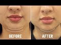 How I Got Rid Of My Double Chin!!