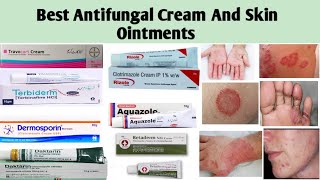 Best Common Antifungal Cream and Skin Ointment Names and Uses