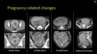 Gynecologic Radiology Anatomy screenshot 5