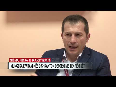 Video: Si Të Trajtohet Rakitizmi Tek Fëmijët