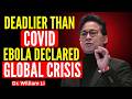 Ebola Virus Outbreak Explained: Symptoms, Spread & Survival | Dr. William Li