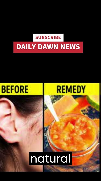 how-to-stop-facial-hair-growth-in-females-naturally-youtube-shorts