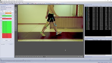 How to use video overlay