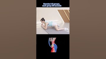 Get straight legs in 30 days | Exercise for bow legs