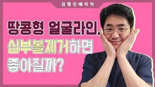 땅콩형 얼굴인데 심부볼제거를 하면?