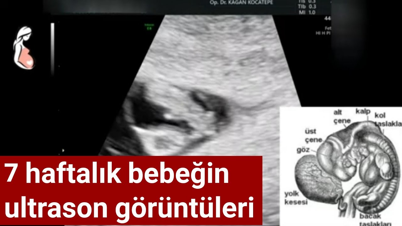 7 haftalik gebelikte bebek ultrason goruntuleri gebelik kesesi yolk kesesi ve kalp atislari youtube