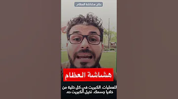 هشاشة العظام Shorts دكريم على 