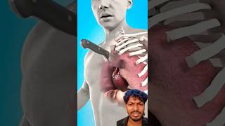 chaku lagne par hota h😲😱 #doctor #facts #anatomy #animation #science #funny #animals #chaku