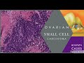 Digital Surgical Pathology 43 Small cell carcinoma of the ovary