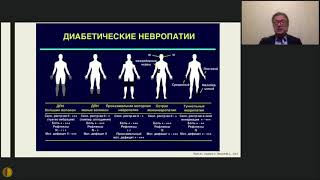 Диабетические полиневропатии: новый взгляд на старые проблемы - Искра Дмитрий Анатольевич