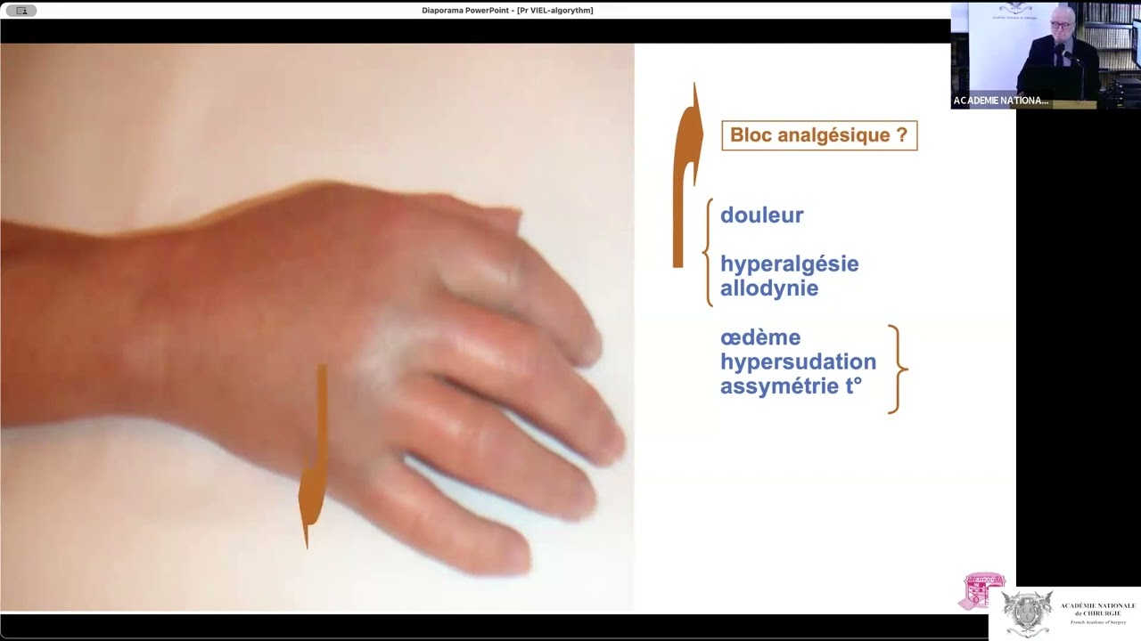 07 Syndrome douloureux régional complexe : vers un algorithme décisionnel