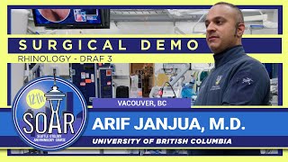 Surgical Demo: DRAF 3 - Arif Janjua, M.D.