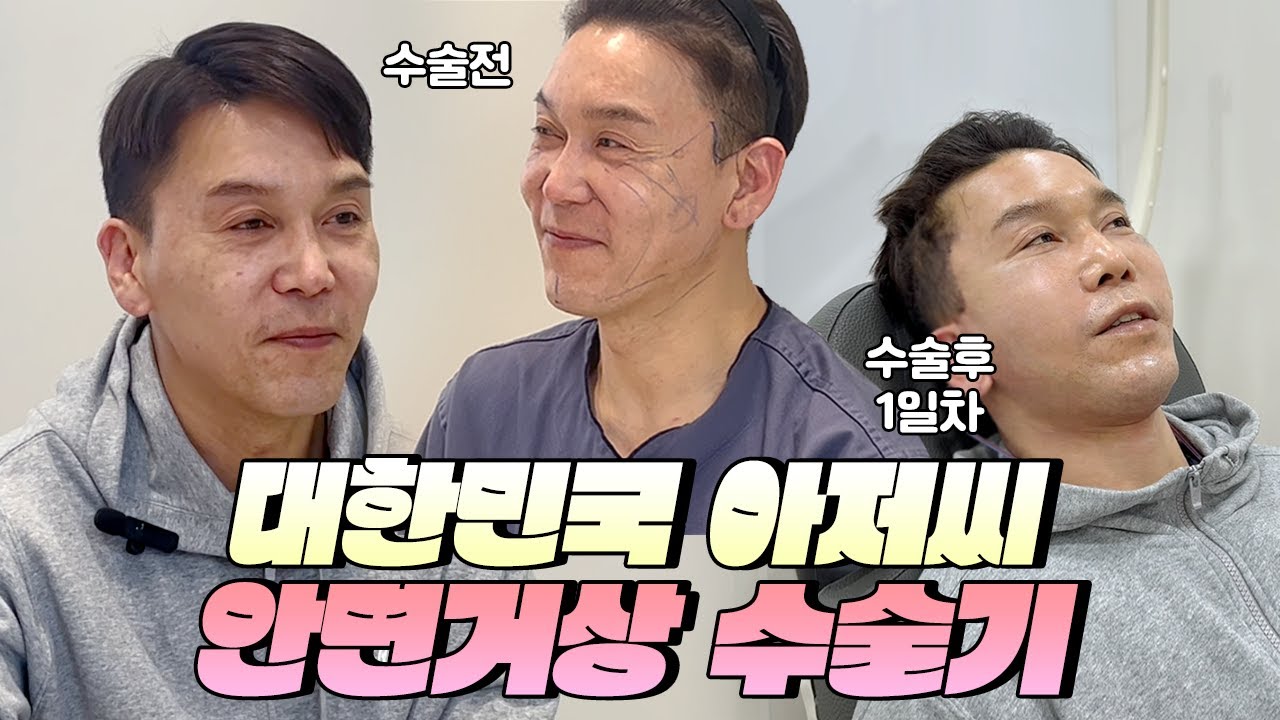 동안성형 끝판왕!! 50대남자 안면거상+목거상 수술 당일 vlog